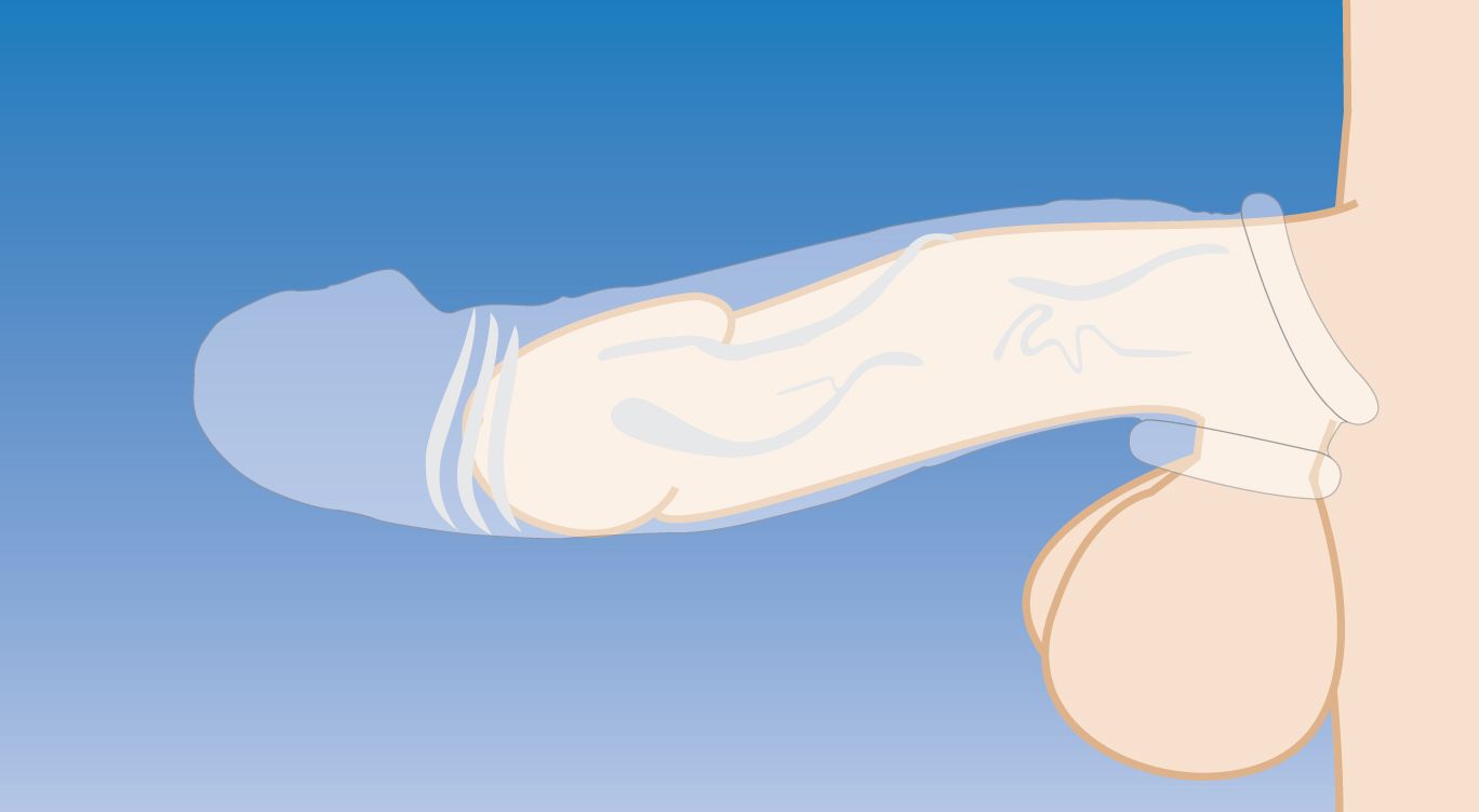 Doorzichtige Extender Gebogen Penissleeve